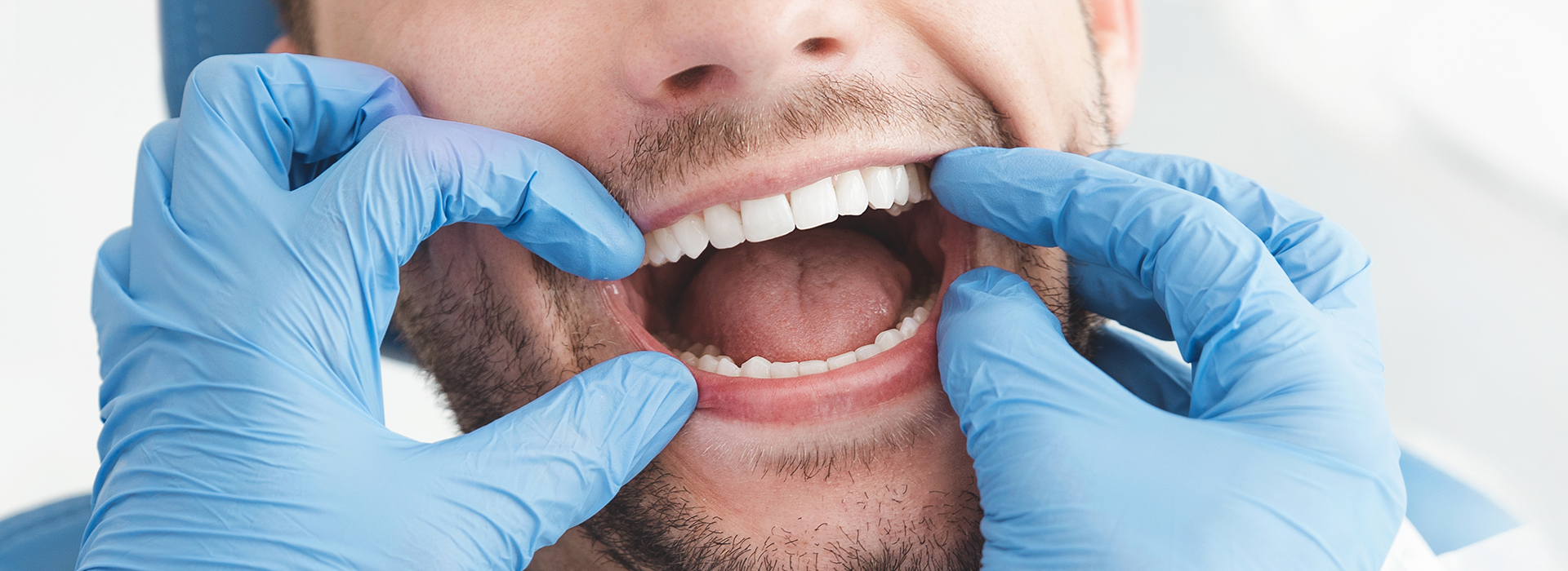 A dental hygienist wearing gloves while cleaning a patient s teeth.