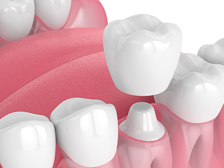 Isbell Dental